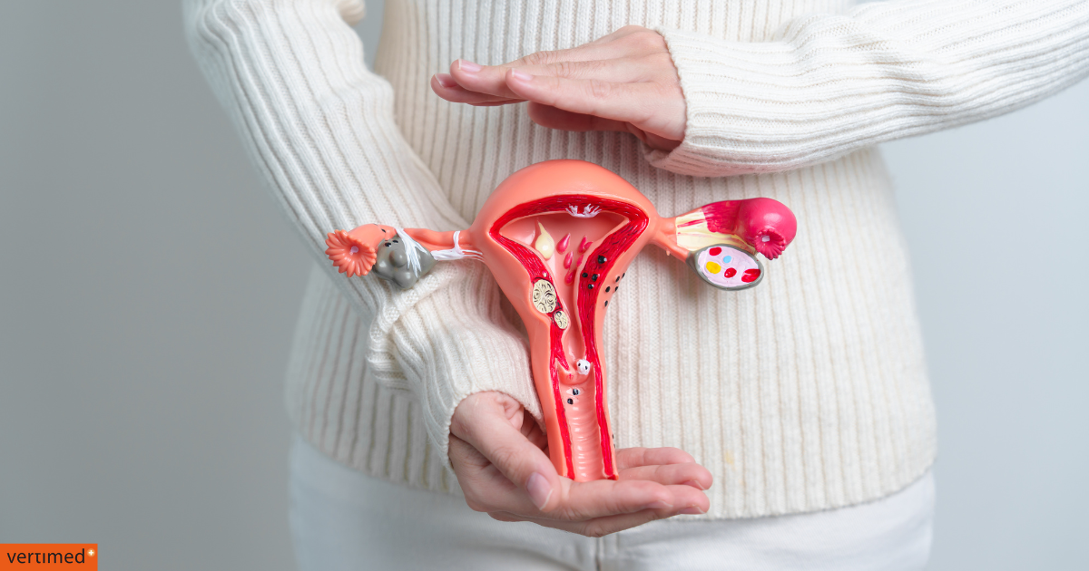 pakiet endometrioza vertimed